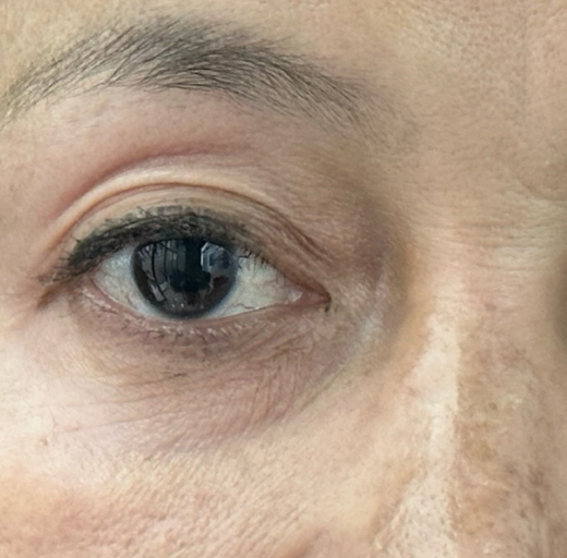 Before/After Image